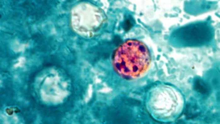 Cyclospora cayetanensis photomicrograph 